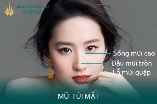 Tướng Mũi Túi Mật Treo Tướng Mũi Túi Mật Treo