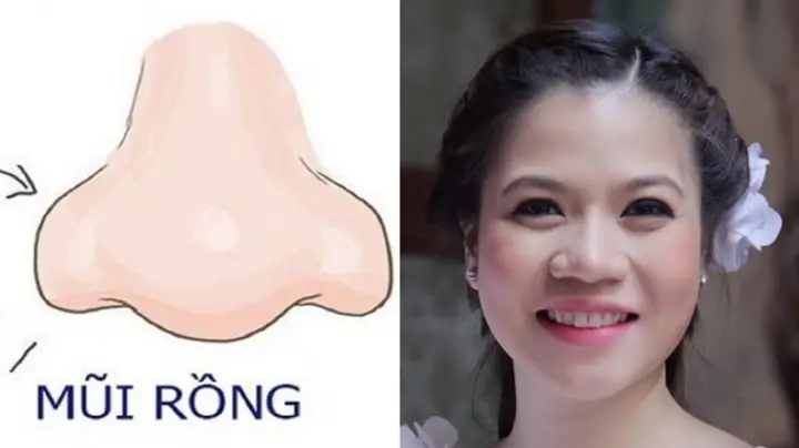 Tướng Mũi Xấu Của Phụ Nữ