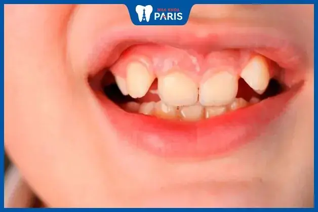 Tướng Răng Cửa Răng Chuột