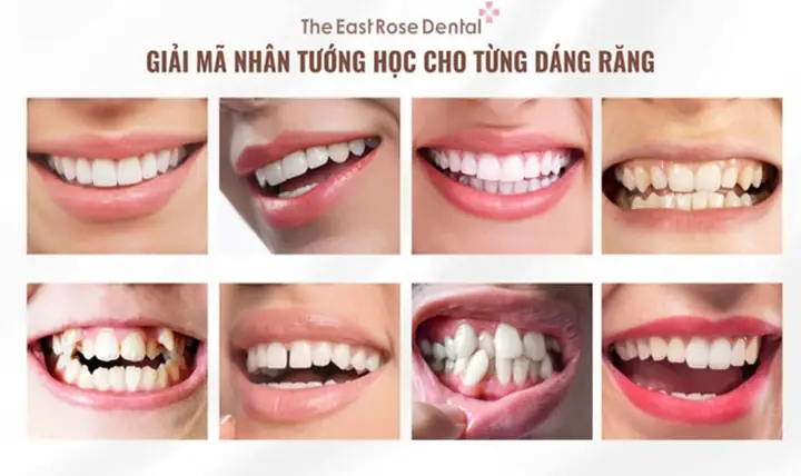 Tướng Răng Cửa Răng Chuột