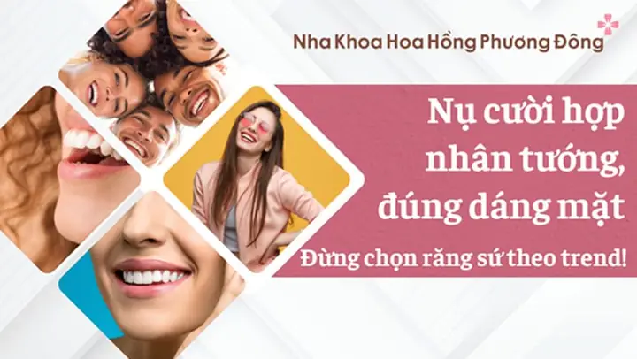Tướng Răng Hình V Tướng Răng Hình V