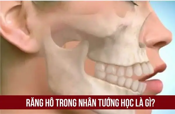 Tướng Răng Hổ Là Như Thế Nào