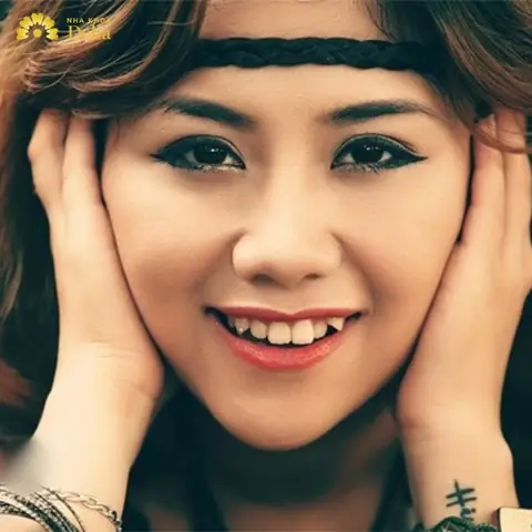 Tướng Răng Hổ Là Như Thế Nào