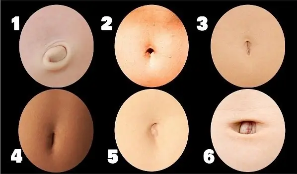 Tướng Rốn Đàn Ông Tướng Rốn Đàn Ông