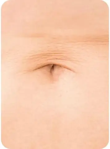 Tướng Rốn Đàn Ông Tướng Rốn Đàn Ông