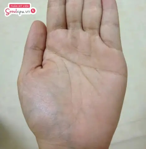 Tướng Số Bàn Tay Đàn Ông