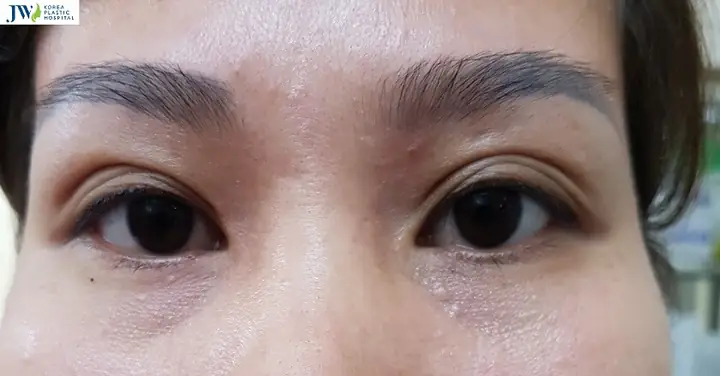 Tướng Số Cho Người Có Mắt 3 Mí