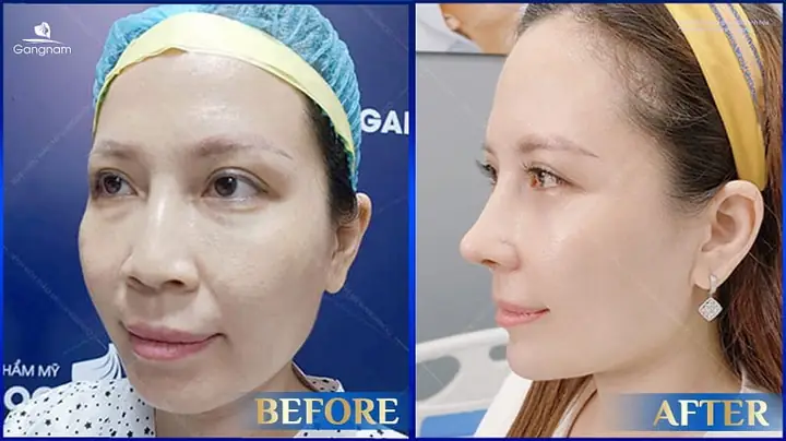 Tướng Số Con Gái Vùng Cằm