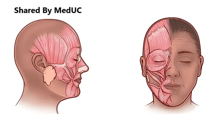 Tướng Số Của Người Có Má Lúm Đồng Tiền