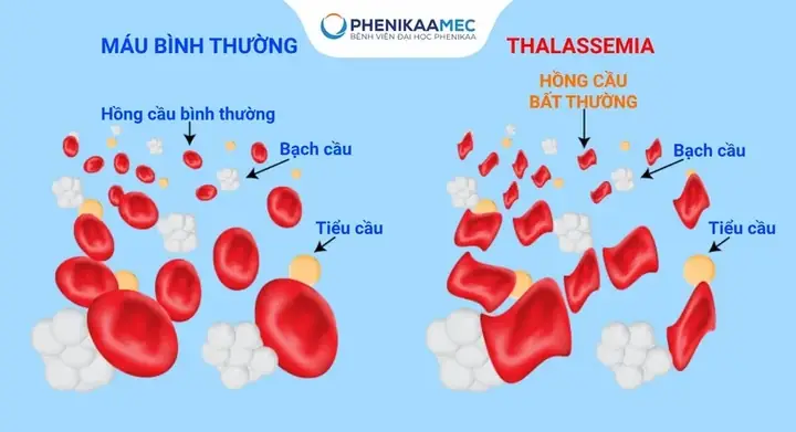 Tướng Số Của Người Có Quai Hàm Bạnh Tướng Số Của Người Có Quai Hàm Bạnh