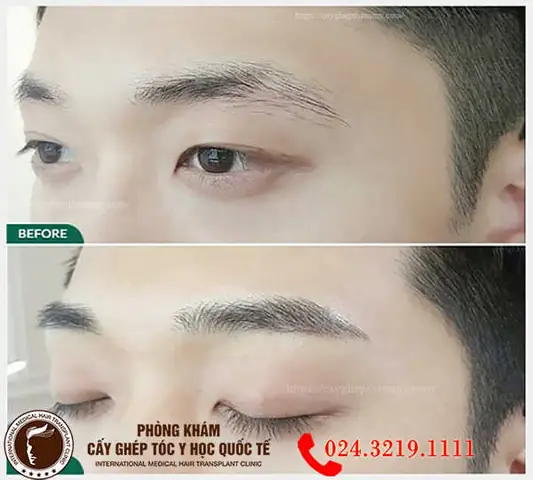 Tướng Số Đàn Ông Lông Mày Nhạt