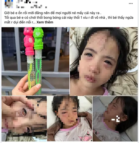 Tướng Số Dang Đi Mình Xà