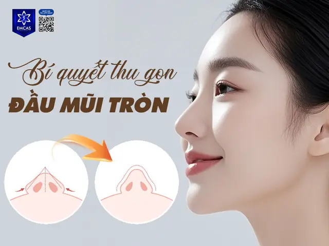 Tướng Số Đầu Mũi Tròn Sống Nhiều Xương