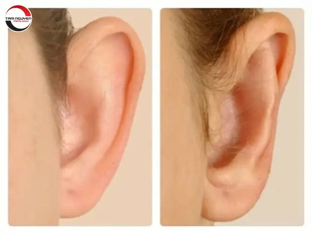 Tướng Số Lỗ Tai