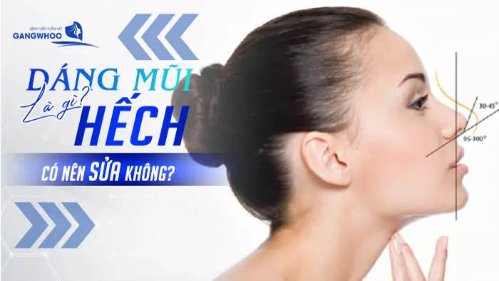 Tướng Số Mũi Có Cục Xương Ở Giữa