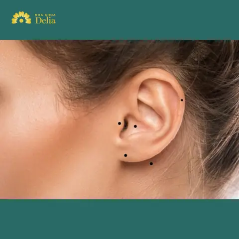Tướng Số Mụn Ruồi Vành Tai Nam
