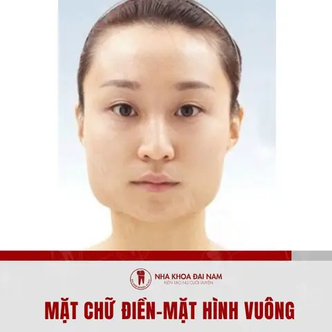 Tướng Số Người Mặt Chữ Điền