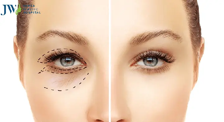 Tướng Số Người Mắt Một Mí