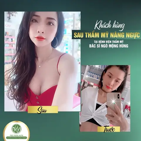 Tướng Số Người Phụ Nữ Ngực Nhỏ