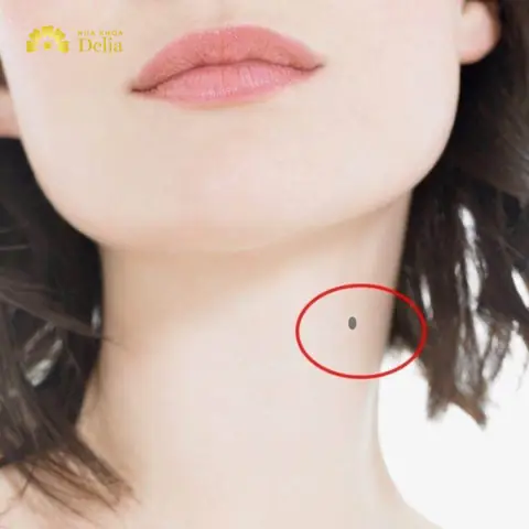 Tướng Số Nốt Ruồi Ở Cổ
