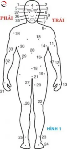 Tướng Số Nốt Ruồi Trên Cơ Thể