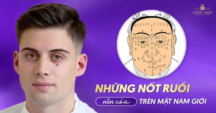 Tướng Số Nốt Ruồi Trên Mặt Nam Giới Tướng Số Nốt Ruồi Trên Mặt Nam Giới