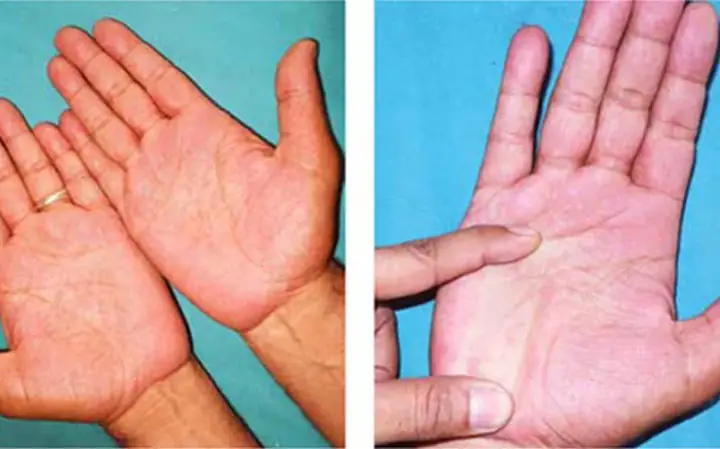 Tướng Số Nữ Có Bàn Tay Nóng