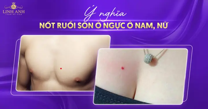 Tướng Số Phụ Nữ Có Lông Vú Nốt Tướng Số Phụ Nữ Có Lông Vú Nốt