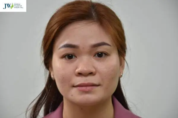 Tướng Số Phụ Nữ Mũi Tẹt