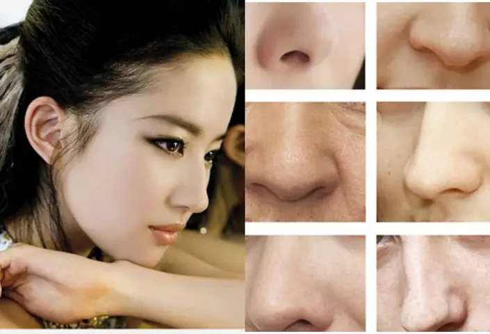 Tướng Số Qua Sống Mũi Tướng Số Qua Sống Mũi