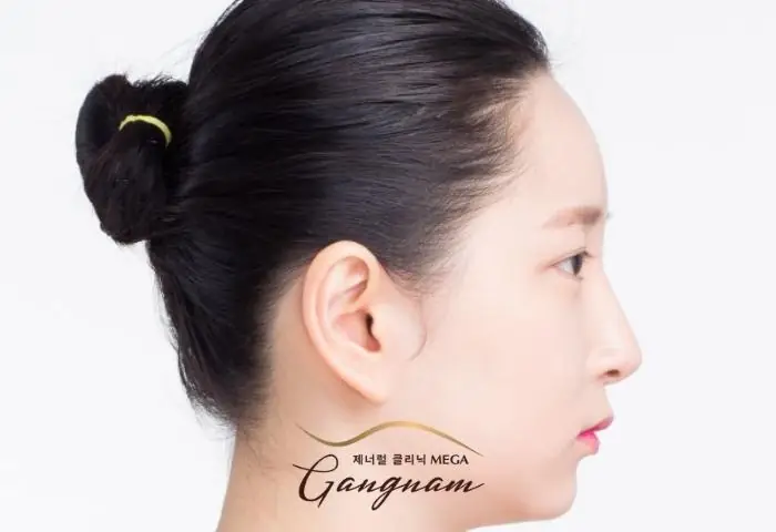 Tướng Số Trán Lõm Tướng Số Trán Lõm