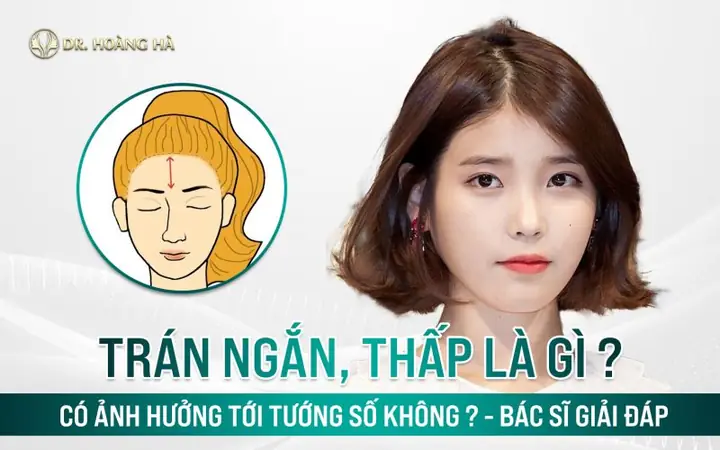 Tướng Số Trán Ngắn