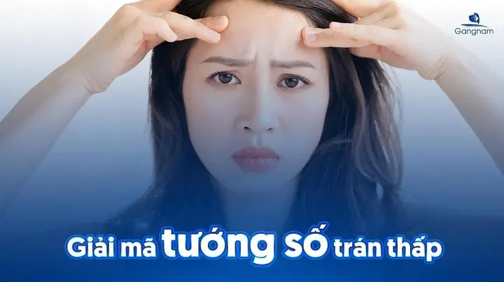 Tướng Số Trán Ngắn Tướng Số Trán Ngắn