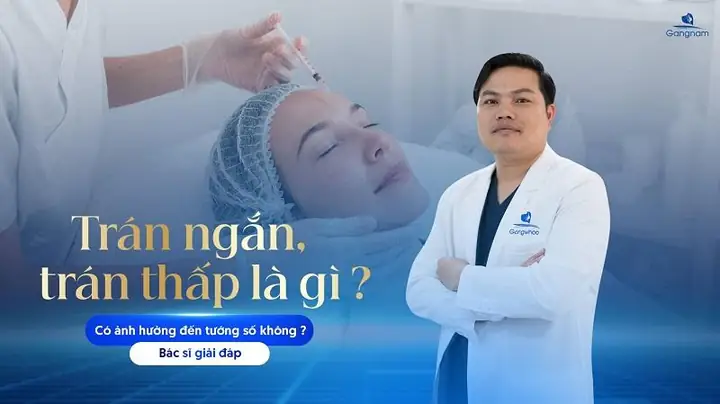 Tướng Số Trán Ngắn Tướng Số Trán Ngắn