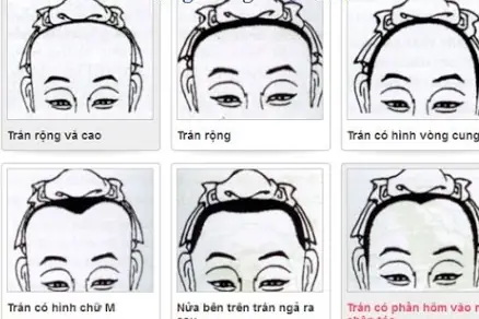 Tướng Số Trán Rộng