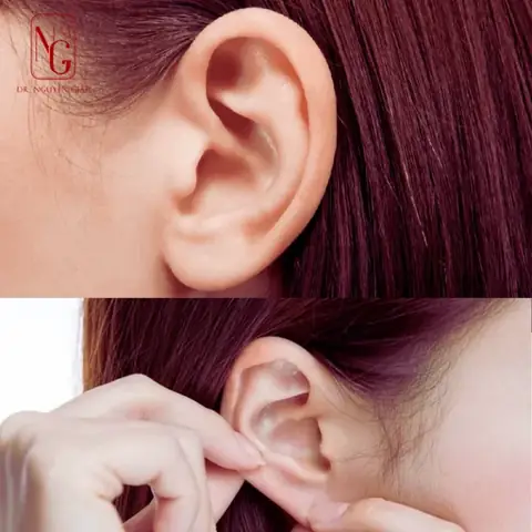Tướng Số Vành Tai