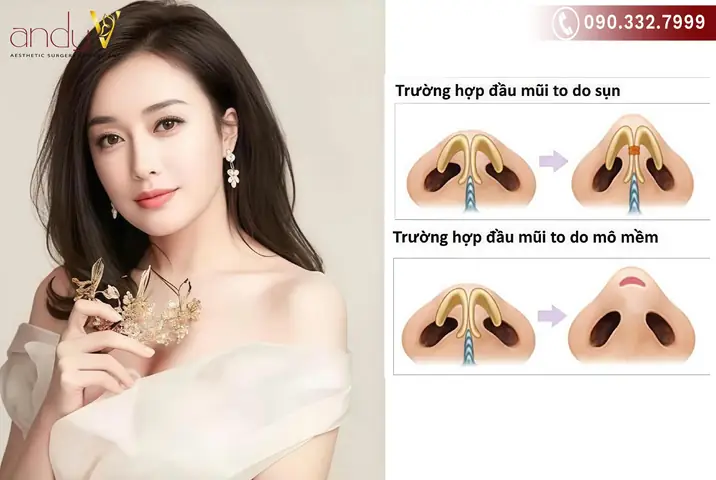 Vàng Và Tướng Mặt Sư Tử