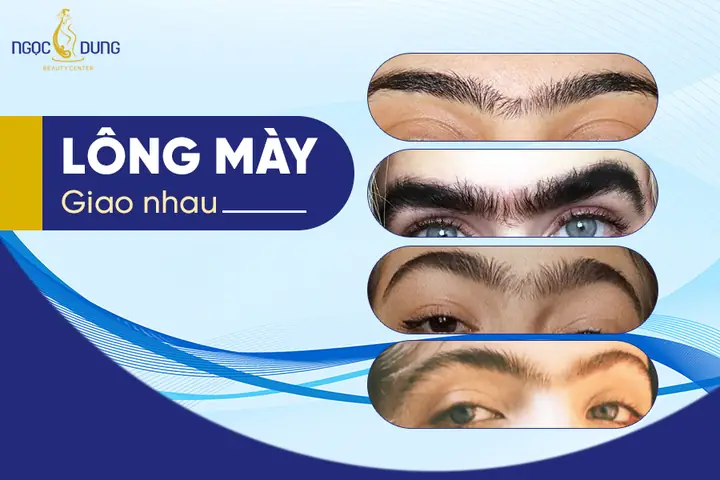 Xem Tướng Lông Mày Nối Nhau Xem Tướng Lông Mày Nối Nhau