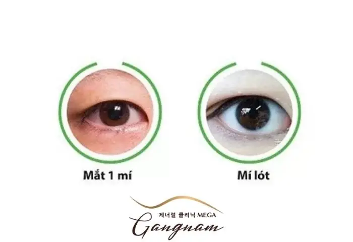Xem Tướng Mắt Mí Lót