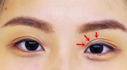Xem Tướng Mắt Nhiều Mí