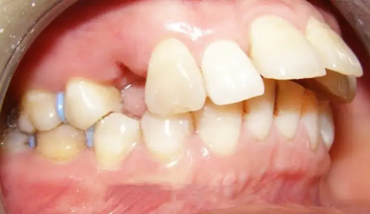 Xem Tướng Miệng Hổ