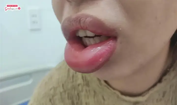Xem Tướng Môi Trề