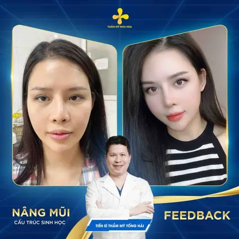Xem Tướng Mũi Giàu Sang Đàn Ông