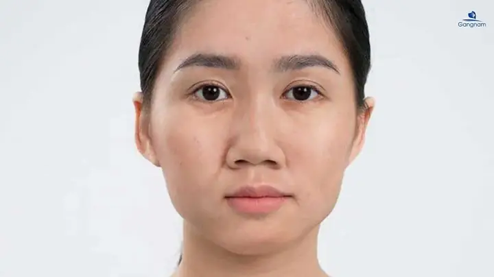 Xem Tướng Mũi Ngắn