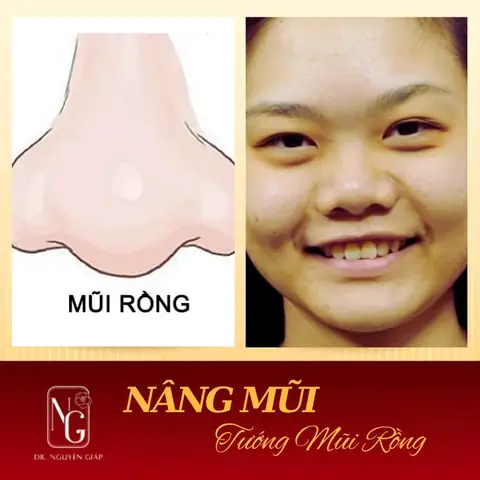 Xem Tướng Mũi Rồng