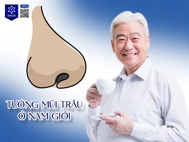 Xem Tướng Mũi Trâu