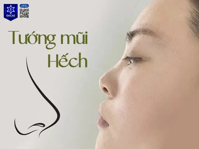 Xem Tướng Mũi Xấu