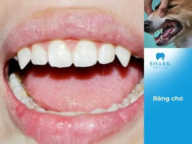 Xem Tướng Răng Chó