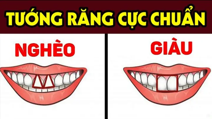 Xem Tướng Răng Cửa Hở Xem Tướng Răng Cửa Hở