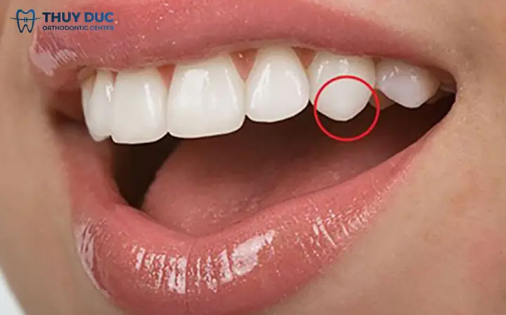 Xem Tướng Răng Đều Xem Tướng Răng Đều